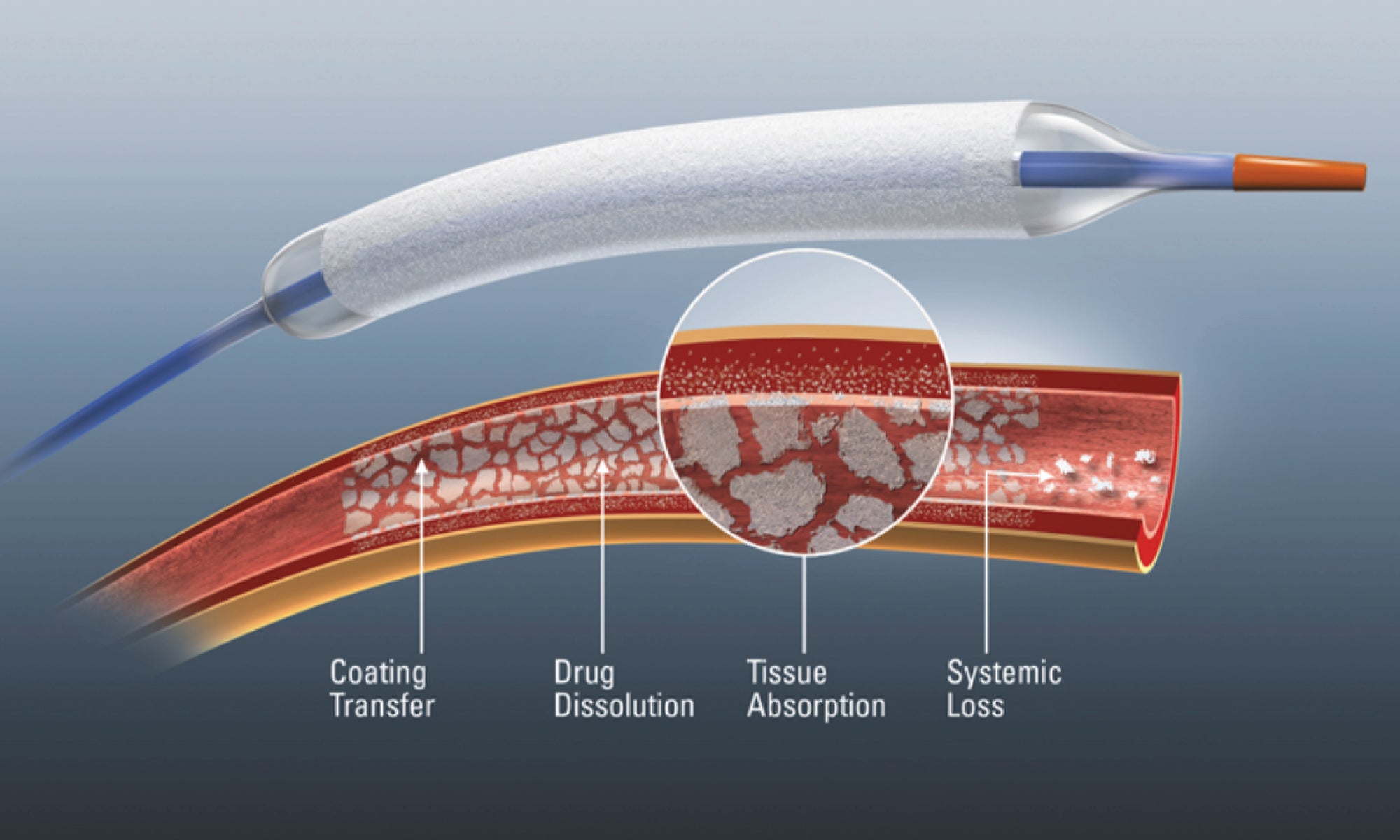 Handbook of Drug-Eluting Stents 英語版 New Peripheral Stent